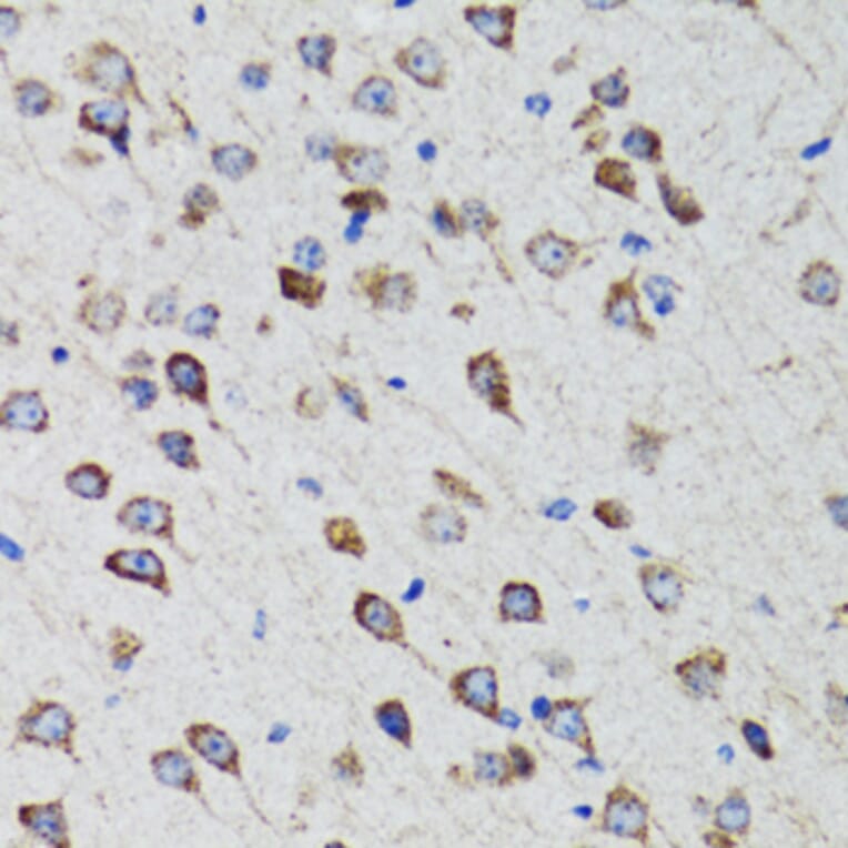 Immunohistochemistry - Anti-HEXA Antibody (A92320) - Antibodies.com