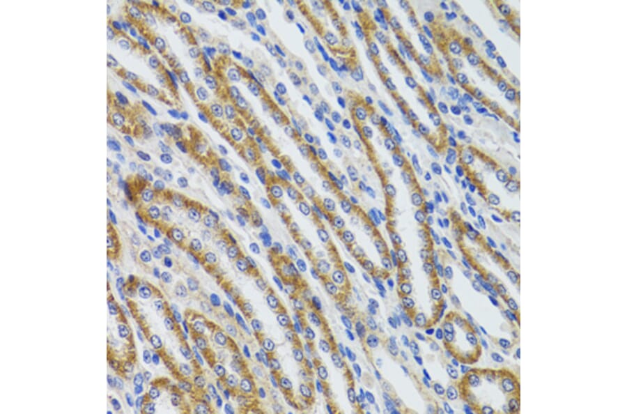 Immunohistochemistry - Anti-HEXA Antibody (A92320) - Antibodies.com