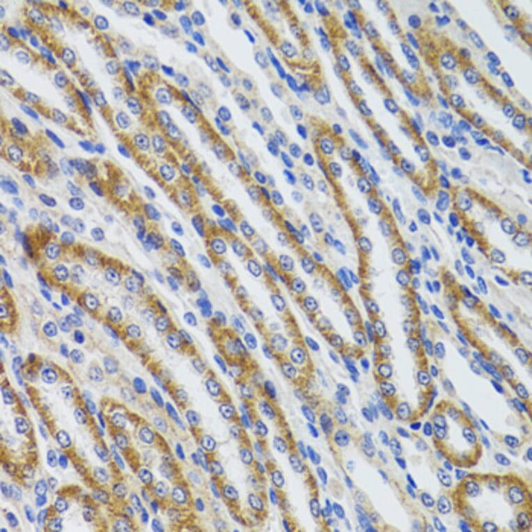 Immunohistochemistry - Anti-HEXA Antibody (A92320) - Antibodies.com