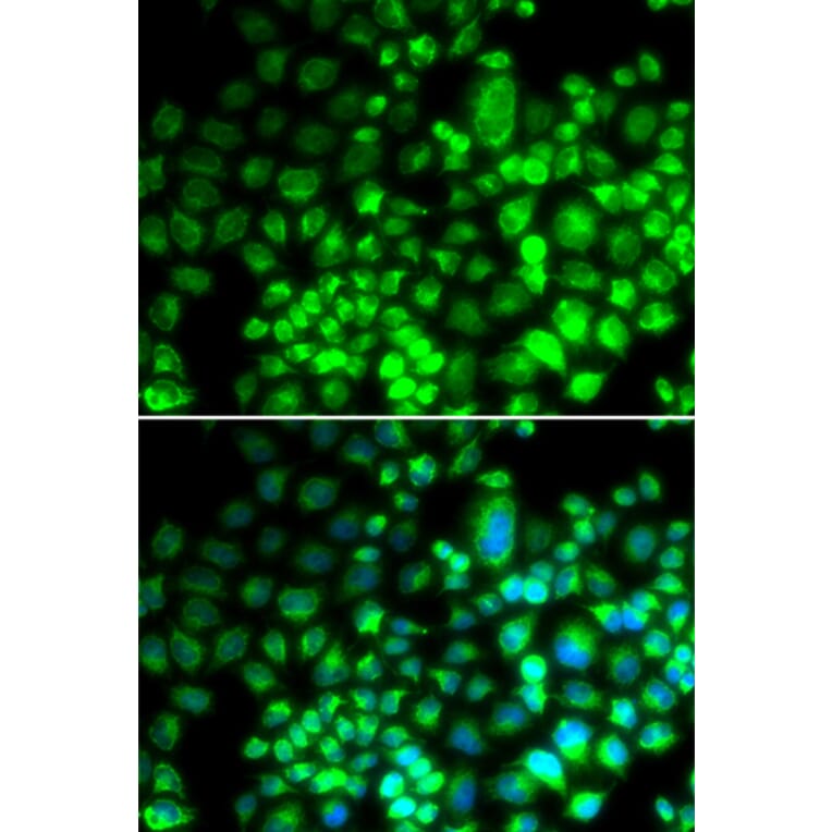 Immunofluorescence - Anti-ST6GAL1 Antibody (A12504) - Antibodies.com