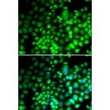 Immunofluorescence - Anti-ST6GAL1 Antibody (A12504) - Antibodies.com