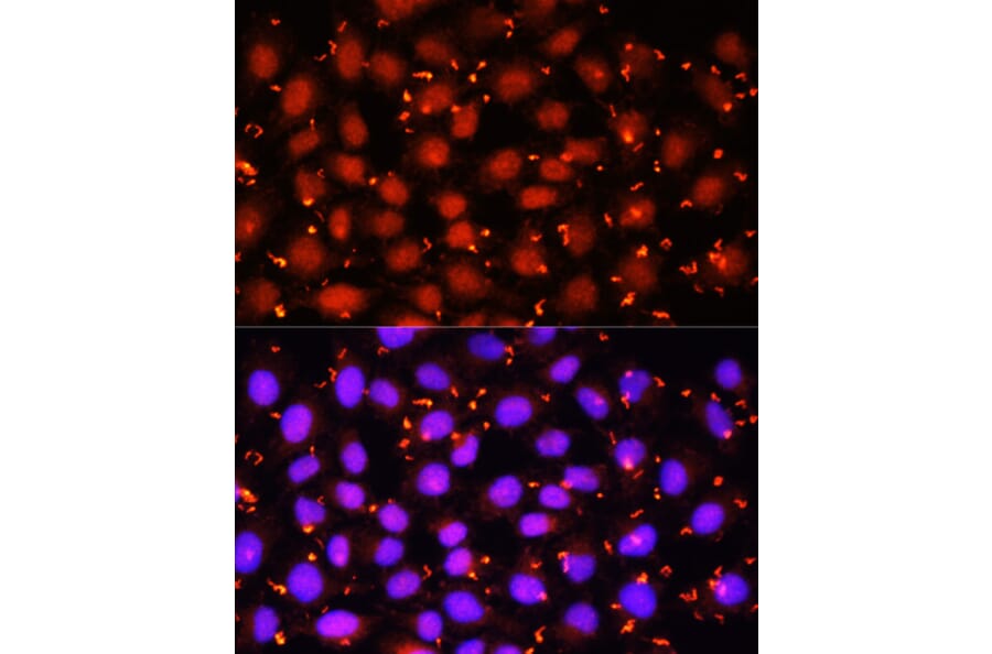 Immunofluorescence - Anti-ACAA1 Antibody (A15018) - Antibodies.com