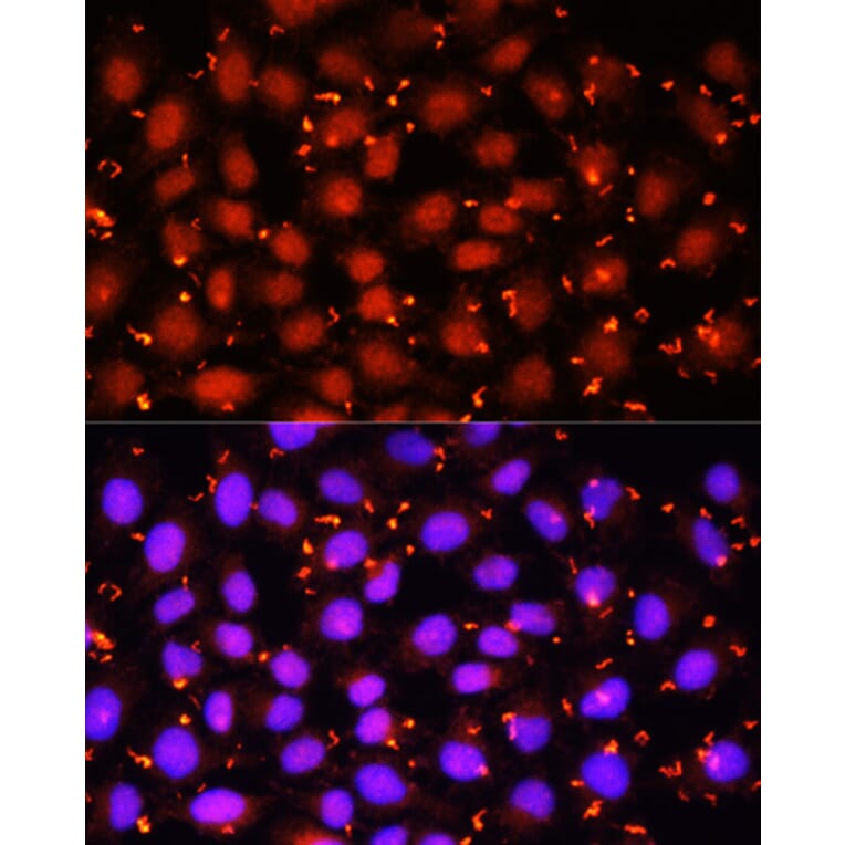 Immunofluorescence - Anti-ACAA1 Antibody (A15018) - Antibodies.com