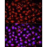 Immunofluorescence - Anti-ACAA1 Antibody (A15018) - Antibodies.com