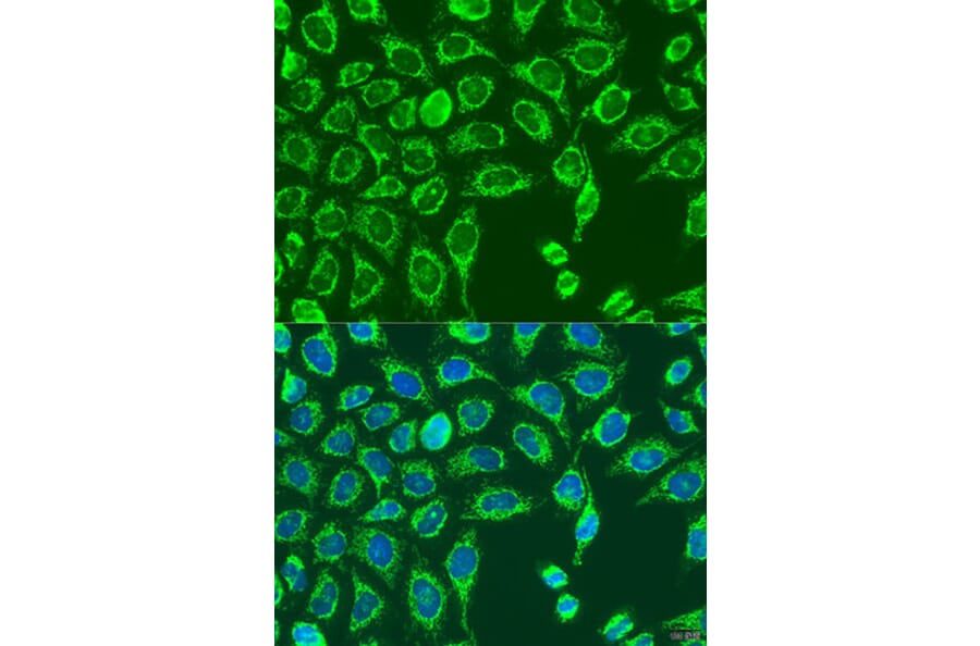 Immunofluorescence - Anti-MATN3 Antibody (A15072) - Antibodies.com