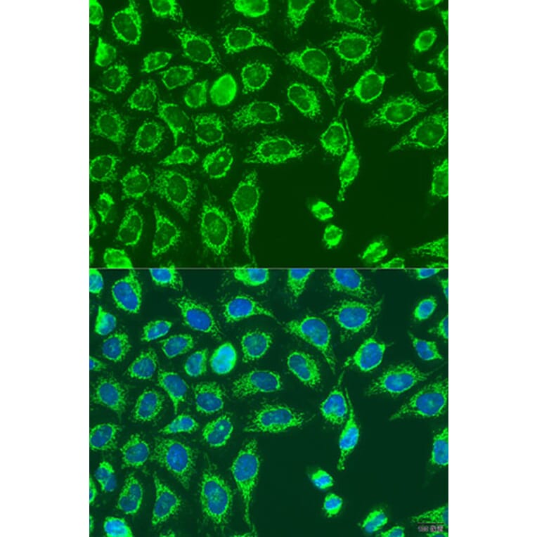 Immunofluorescence - Anti-MATN3 Antibody (A15072) - Antibodies.com