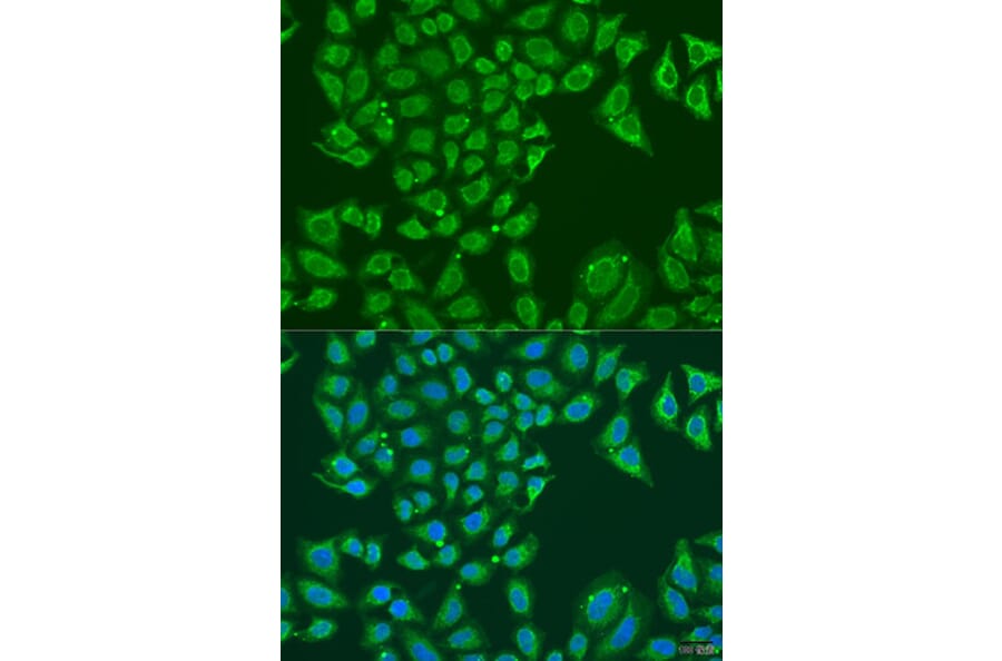 Immunofluorescence - Anti-ALDH1B1 Antibody (A92327) - Antibodies.com