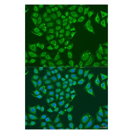 Immunofluorescence - Anti-ALDH1B1 Antibody (A92327) - Antibodies.com