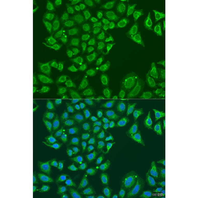 Immunofluorescence - Anti-ALDH1B1 Antibody (A92327) - Antibodies.com