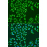 Immunofluorescence - Anti-ALDH1B1 Antibody (A92327) - Antibodies.com