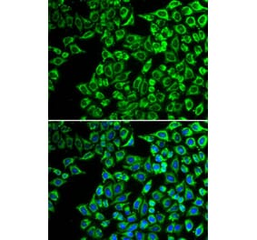 Immunofluorescence - Anti-LIPC Antibody (A92328) - Antibodies.com