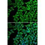 Immunofluorescence - Anti-LIPC Antibody (A92328) - Antibodies.com