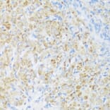 Immunohistochemistry - Anti-BMP2 Antibody (A15647) - Antibodies.com
