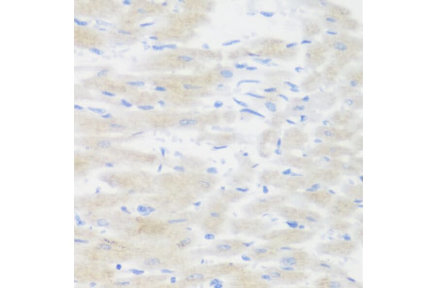 Immunohistochemistry - Anti-BMP2 Antibody (A15647) - Antibodies.com