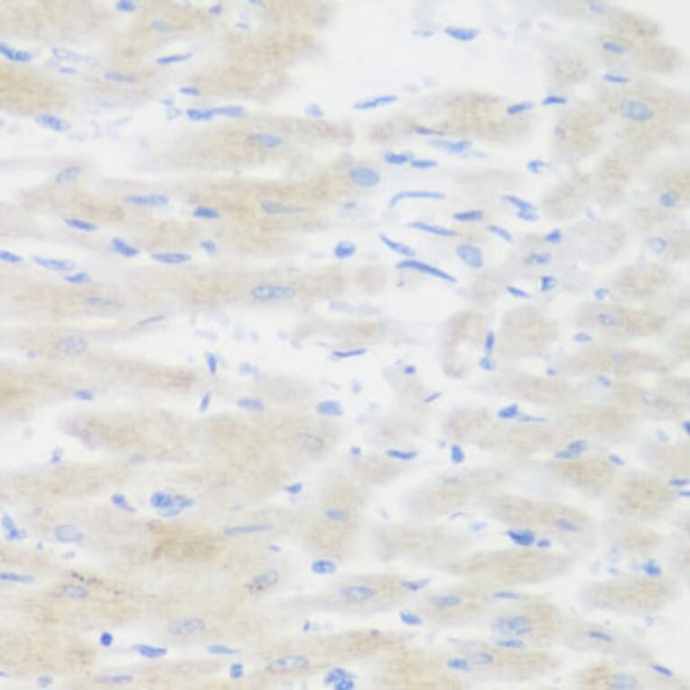 Immunohistochemistry - Anti-BMP2 Antibody (A15647) - Antibodies.com
