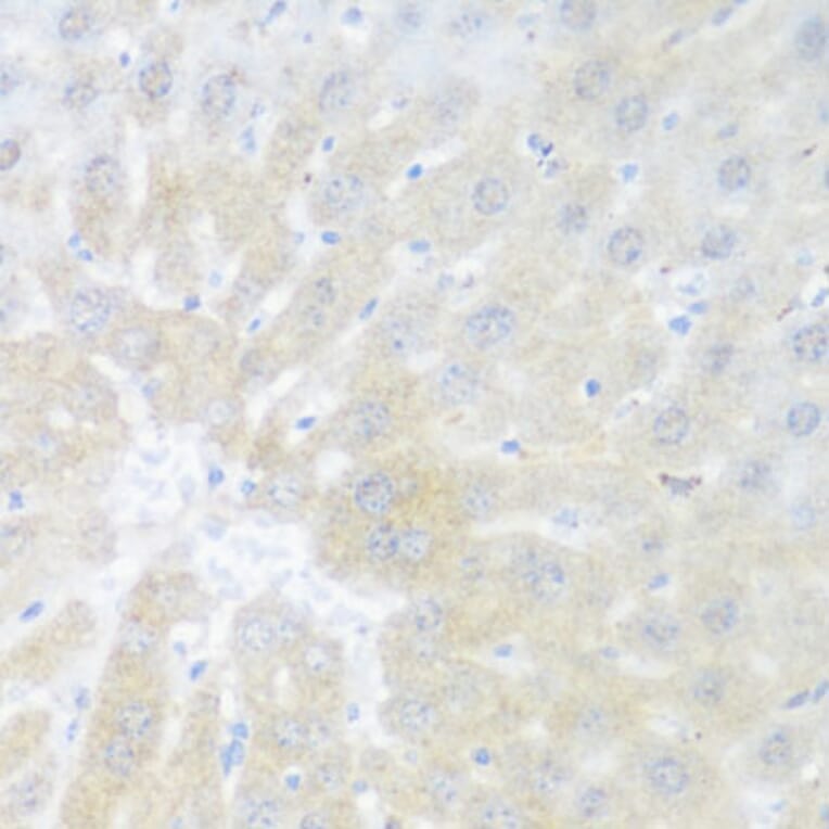 Immunohistochemistry - Anti-BMP2 Antibody (A15647) - Antibodies.com