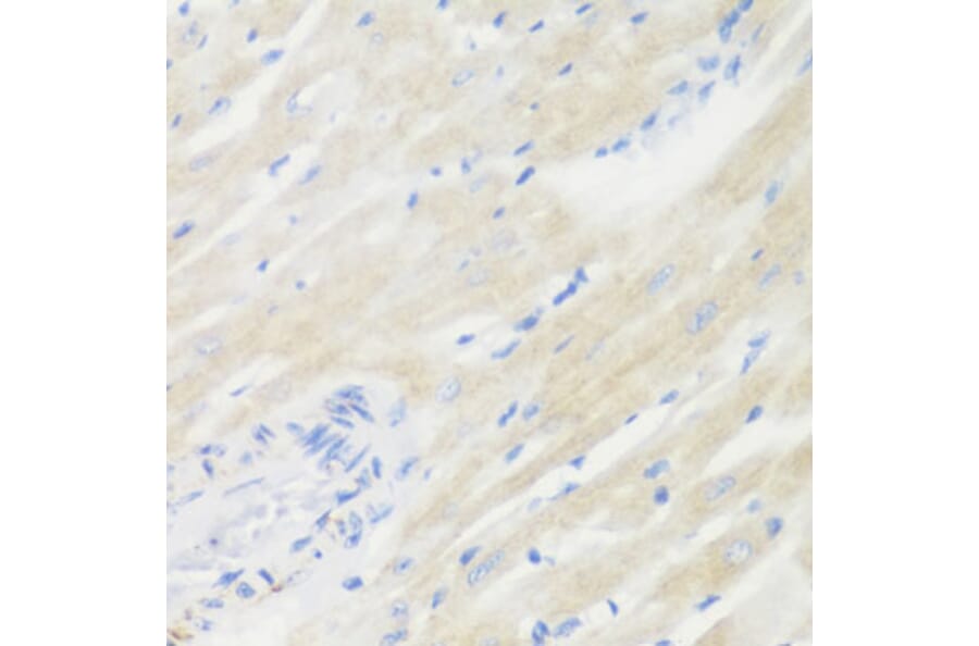 Immunohistochemistry - Anti-BMP2 Antibody (A15647) - Antibodies.com