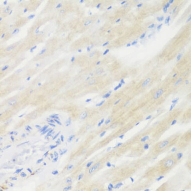 Immunohistochemistry - Anti-BMP2 Antibody (A15647) - Antibodies.com