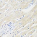 Immunohistochemistry - Anti-BMP2 Antibody (A15647) - Antibodies.com