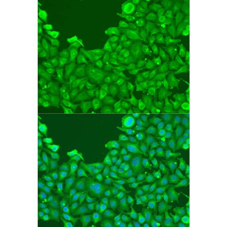 Immunofluorescence - Anti-BMP2 Antibody (A15647) - Antibodies.com
