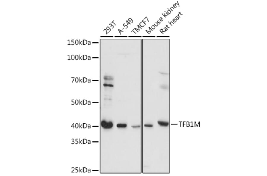 Western Blot - Anti-TFB1M Antibody (A92330) - Antibodies.com