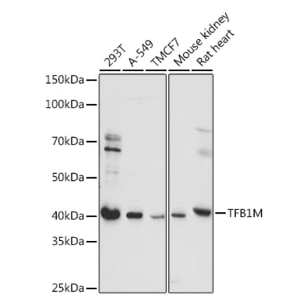 Western Blot - Anti-TFB1M Antibody (A92330) - Antibodies.com