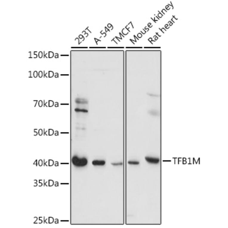 Western Blot - Anti-TFB1M Antibody (A92330) - Antibodies.com