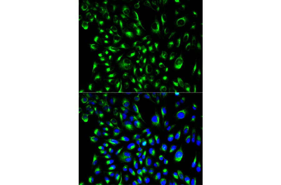 Immunofluorescence - Anti-LCP2 Antibody (A13505) - Antibodies.com