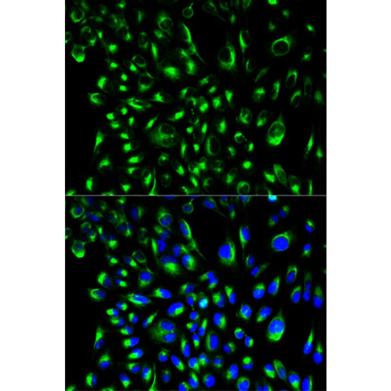 Immunofluorescence - Anti-LCP2 Antibody (A13505) - Antibodies.com