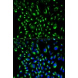 Immunofluorescence - Anti-LCP2 Antibody (A13505) - Antibodies.com