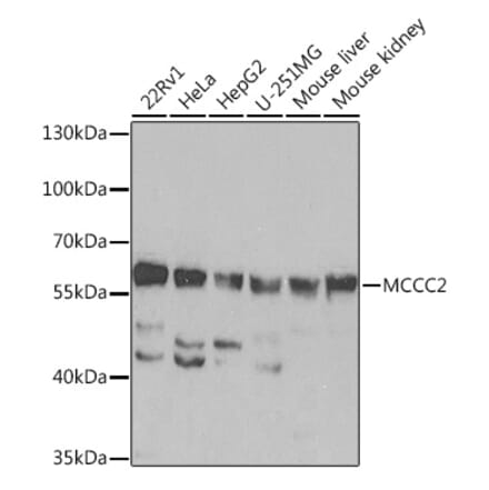 Western Blot - Anti-MCCC2 Antibody (A92332) - Antibodies.com