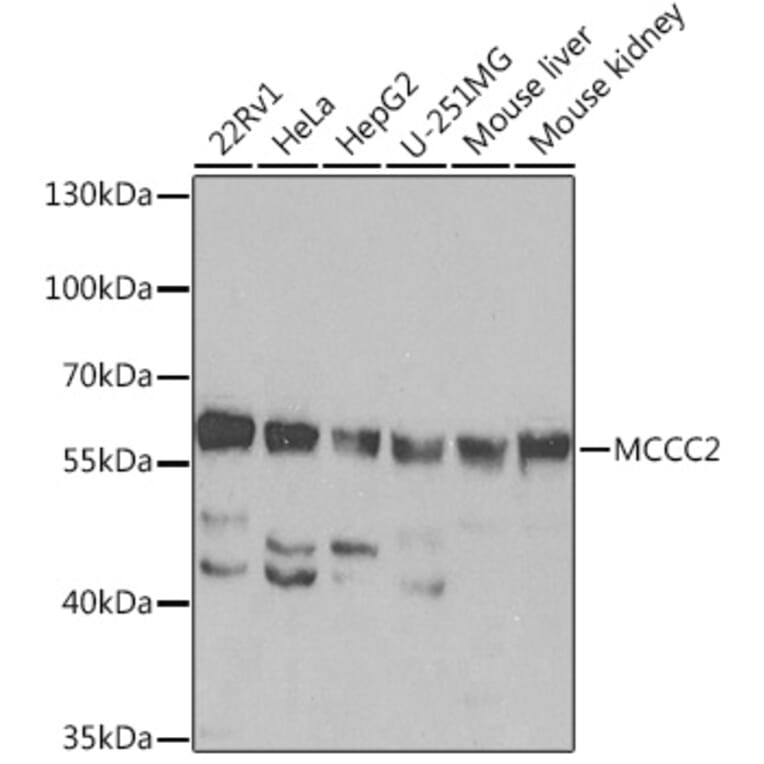 Western Blot - Anti-MCCC2 Antibody (A92332) - Antibodies.com