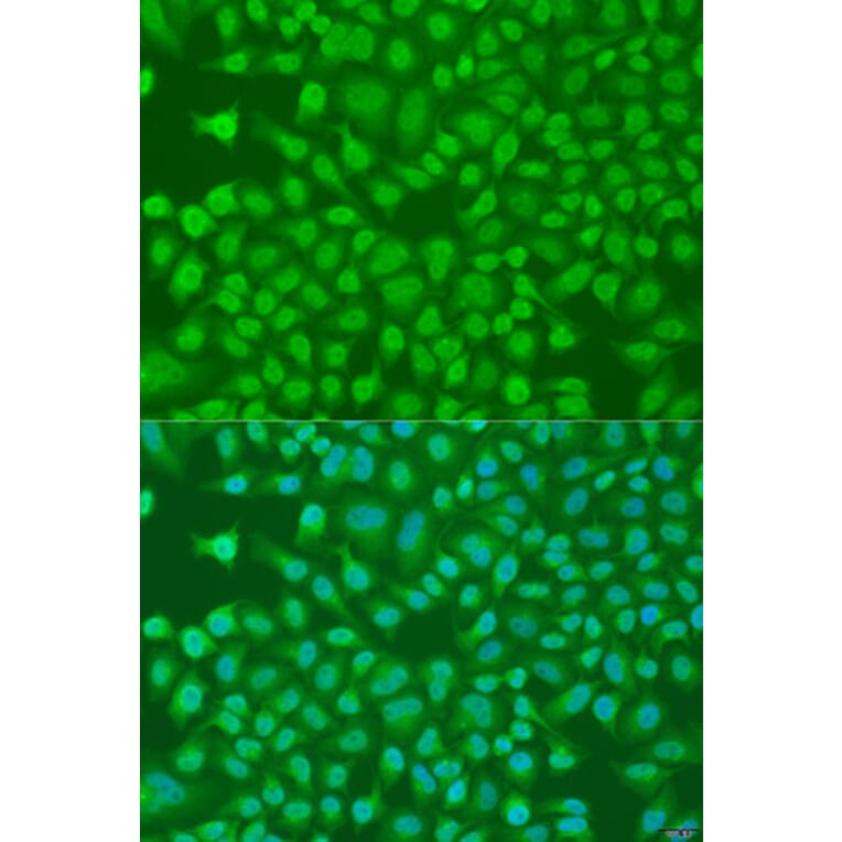 Immunofluorescence - Anti-PLEKHA1 Antibody (A16009) - Antibodies.com