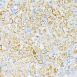 Immunohistochemistry - Anti-USP33 Antibody (A92337) - Antibodies.com