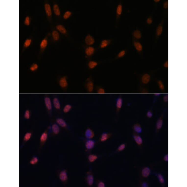 Immunofluorescence - Anti-USP33 Antibody (A92337) - Antibodies.com