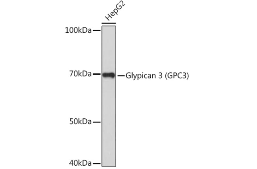 Western Blot - Anti-Glypican 3 Antibody (A92339) - Antibodies.com