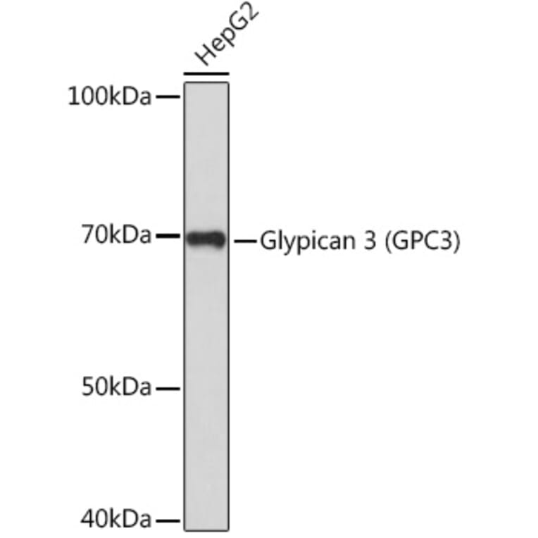 Western Blot - Anti-Glypican 3 Antibody (A92339) - Antibodies.com