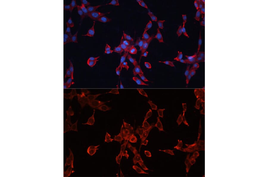 Immunofluorescence - Anti-Glypican 3 Antibody (A92339) - Antibodies.com