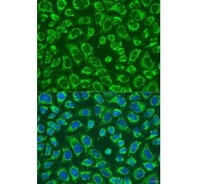 Immunofluorescence - Anti-MAP4K5 Antibody (A92345) - Antibodies.com