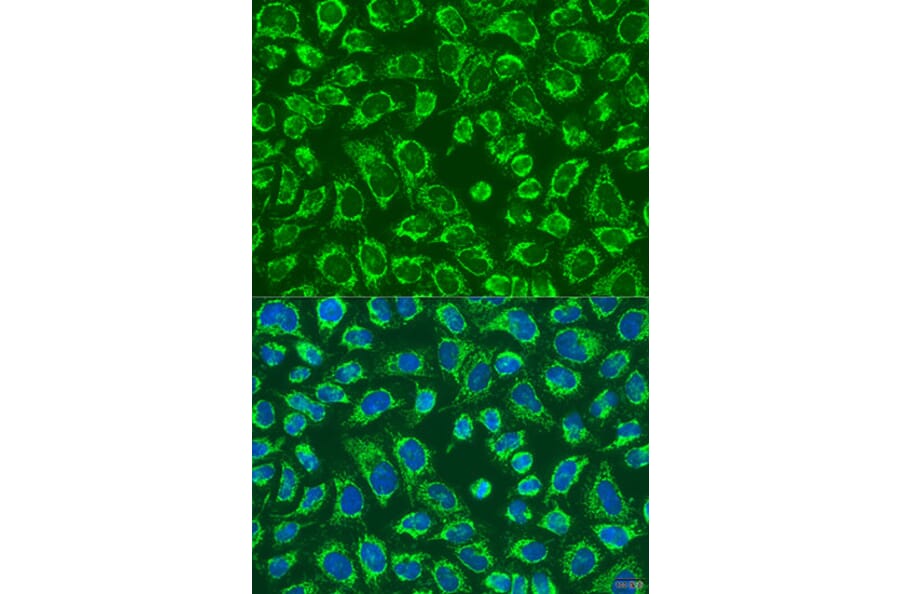 Immunofluorescence - Anti-MAP4K5 Antibody (A92345) - Antibodies.com