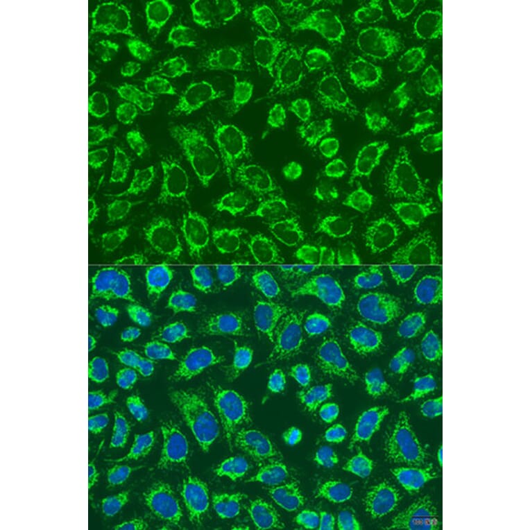 Immunofluorescence - Anti-MAP4K5 Antibody (A92345) - Antibodies.com