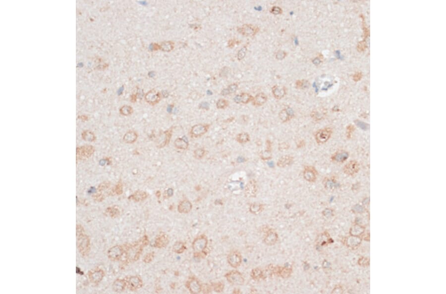 Immunohistochemistry - Anti-CDH18 Antibody (A14645) - Antibodies.com