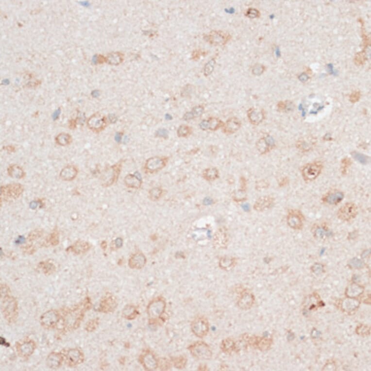 Immunohistochemistry - Anti-CDH18 Antibody (A14645) - Antibodies.com