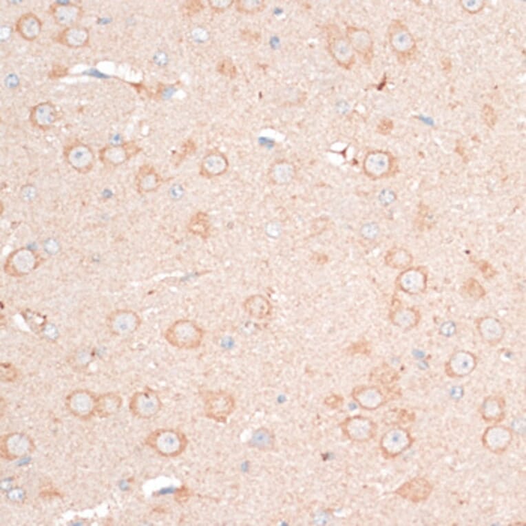 Immunohistochemistry - Anti-CDH18 Antibody (A14645) - Antibodies.com