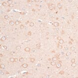 Immunohistochemistry - Anti-CDH18 Antibody (A14645) - Antibodies.com