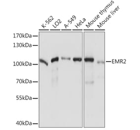 Western Blot - Anti-EMR2 Antibody (A92347) - Antibodies.com