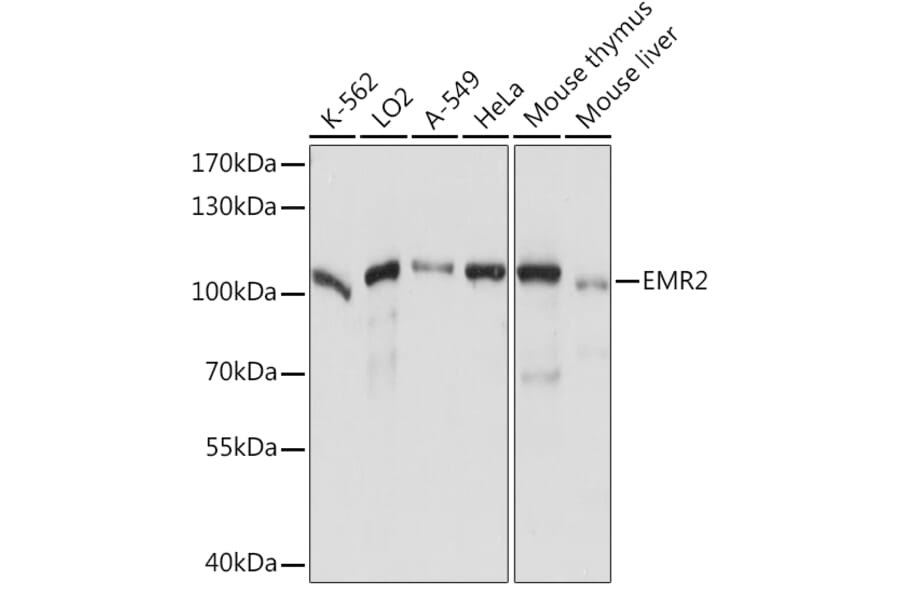 Western Blot - Anti-EMR2 Antibody (A92347) - Antibodies.com