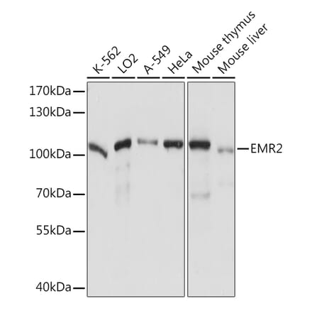 EMR2 Antibodies | Antibodies.com