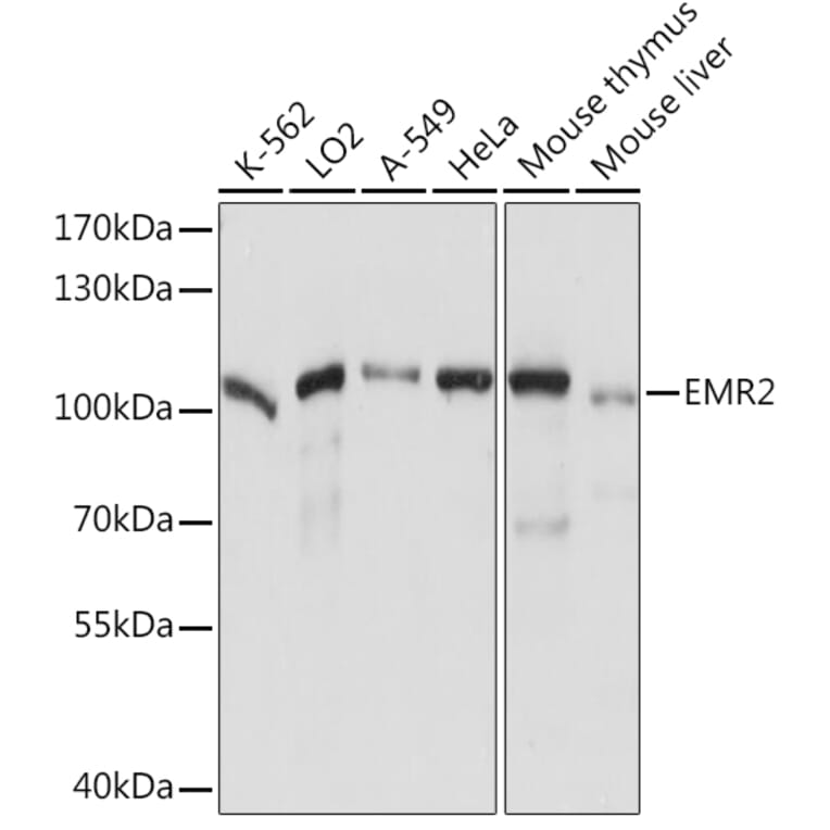 Western Blot - Anti-EMR2 Antibody (A92347) - Antibodies.com