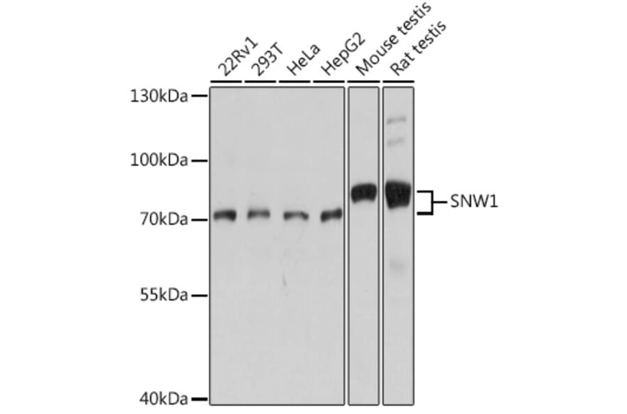 Western Blot - Anti-NCOA62/SNW1 Antibody (A92348) - Antibodies.com